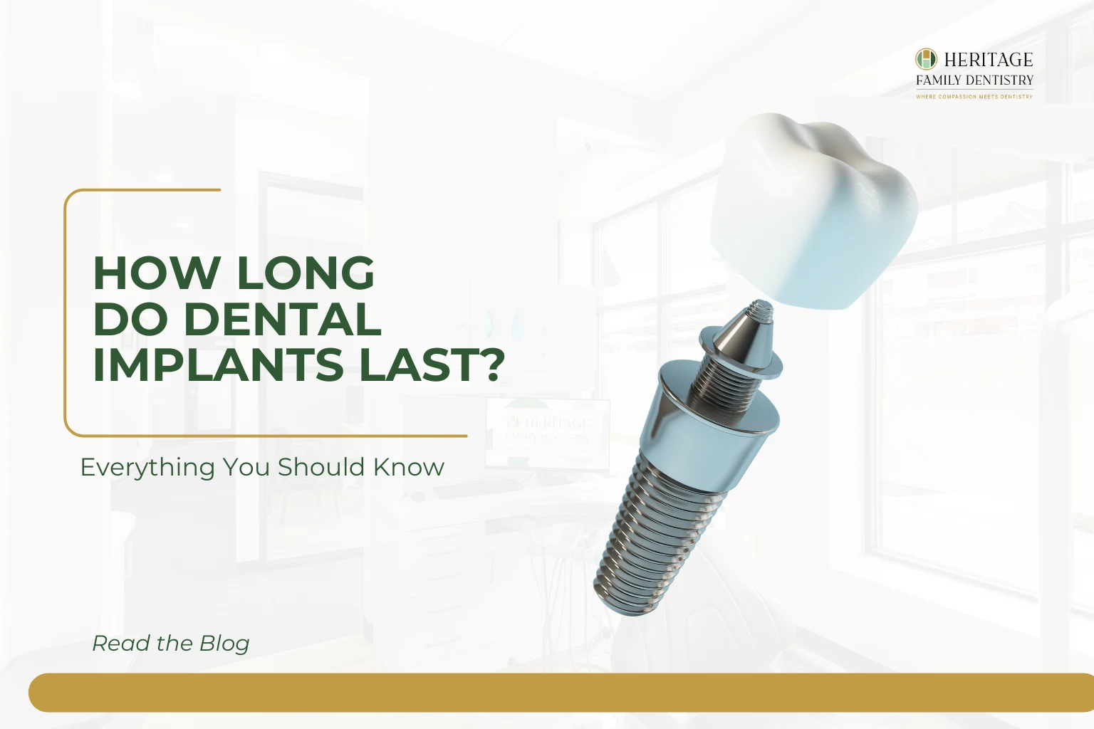 How Long Do Dental Implants Last? Everything You Should Know