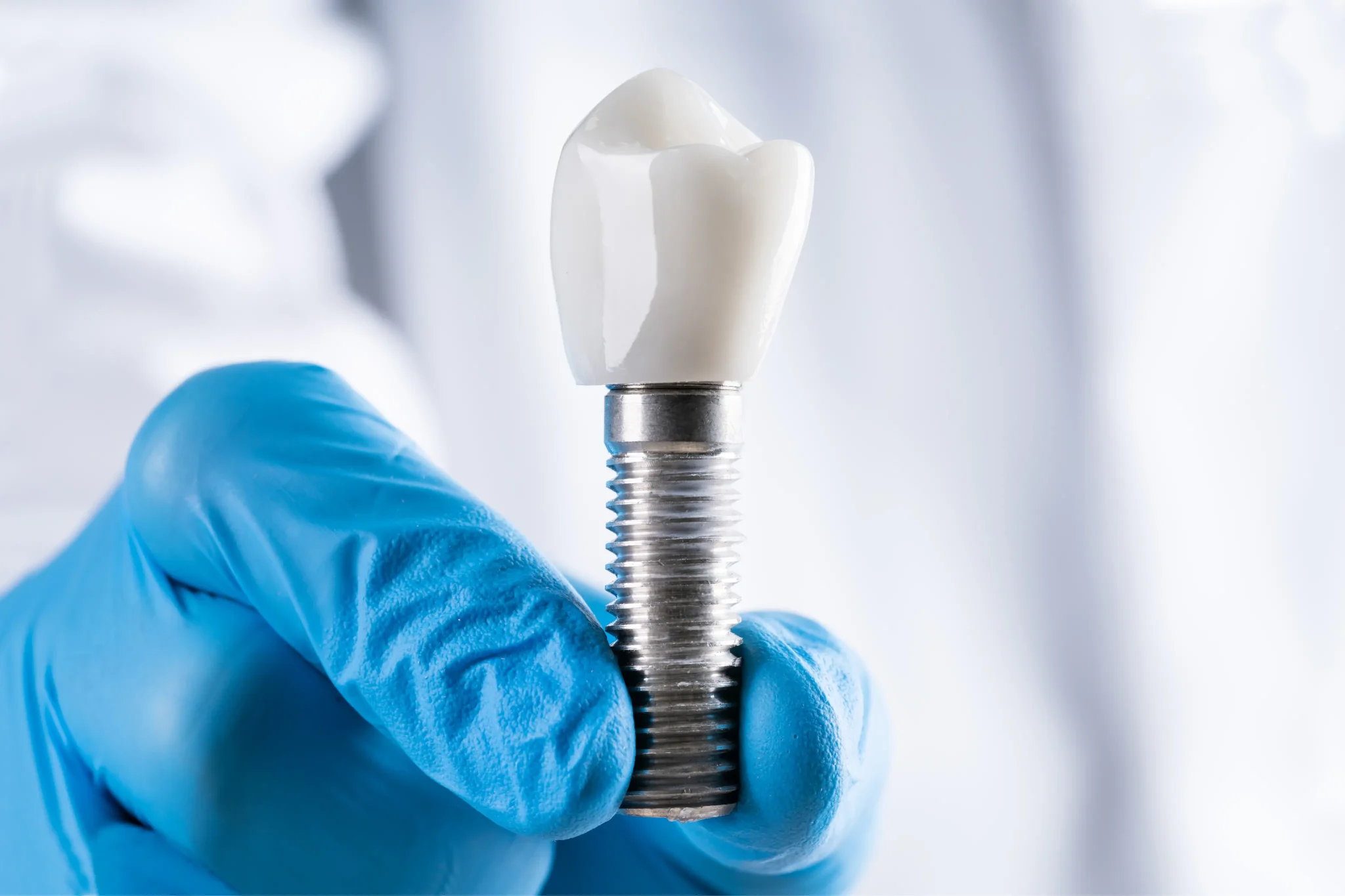 Dental implants